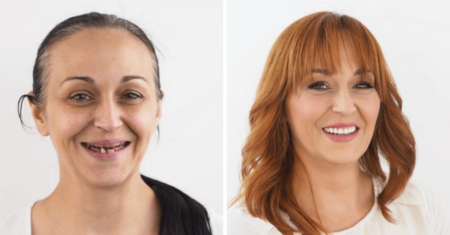 U Hrvatskoj započinje najpoznatiji dentalni makeover! Prijavite se i vi! Mirela
