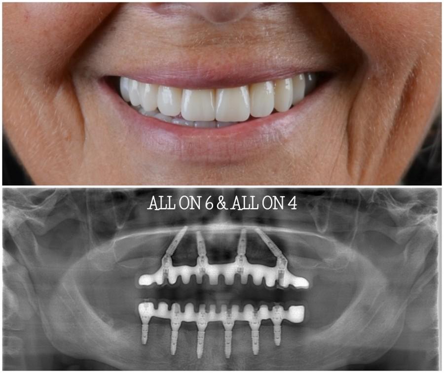 SALONA DENTAL – STOMATOLOŠKA POLIKLINIKA: "Sve stomatološke usluge na jednom mjestu!" salona dental (4)