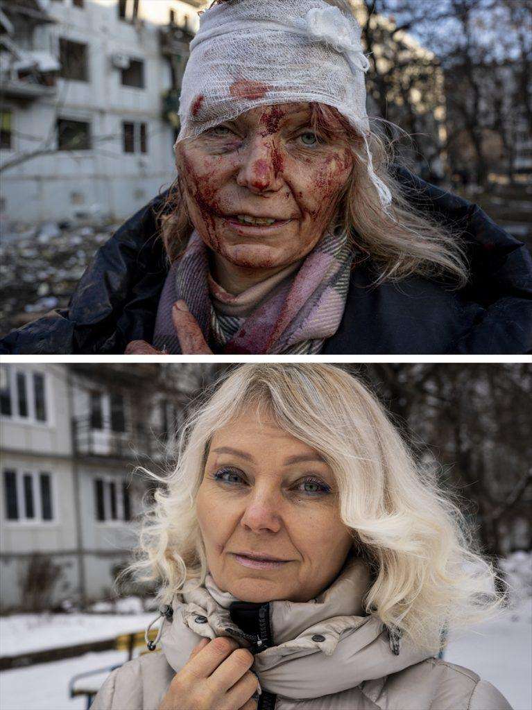 NAKON DVIJE GODINA VRATILA SE U UKRAJINU: Olena Kurilo, čija je fotografija postala simbol rusko-ukrajinskog rata, vratila se doma u Harkiv