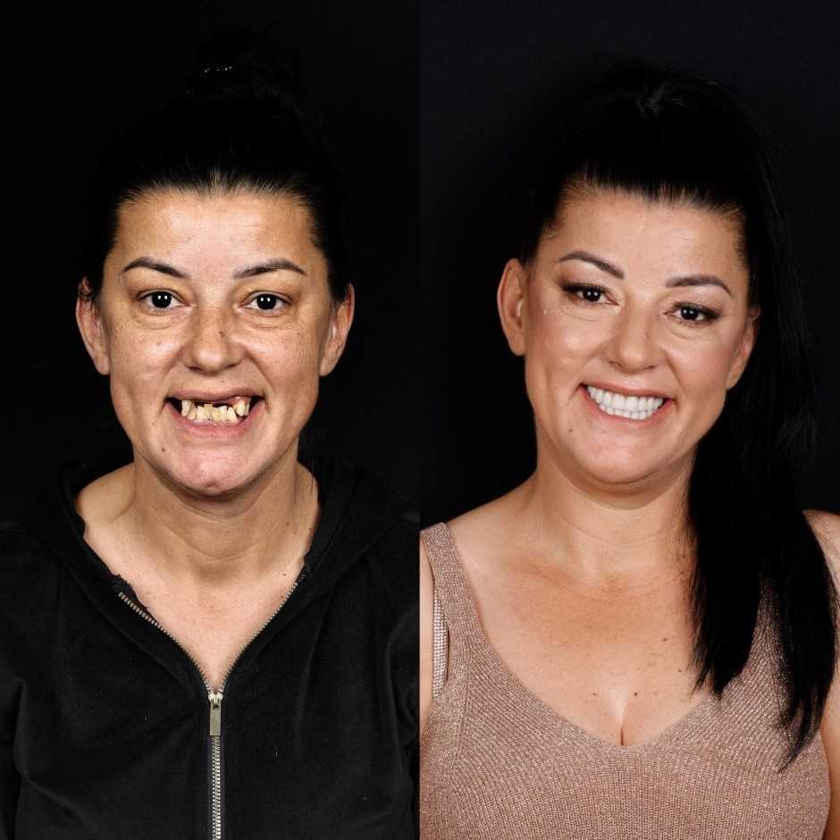 STOMATOLOŠKA POLIKLINIKA SALONA DENTAL: Centar vrhunske stomatologije u Dalmaciji